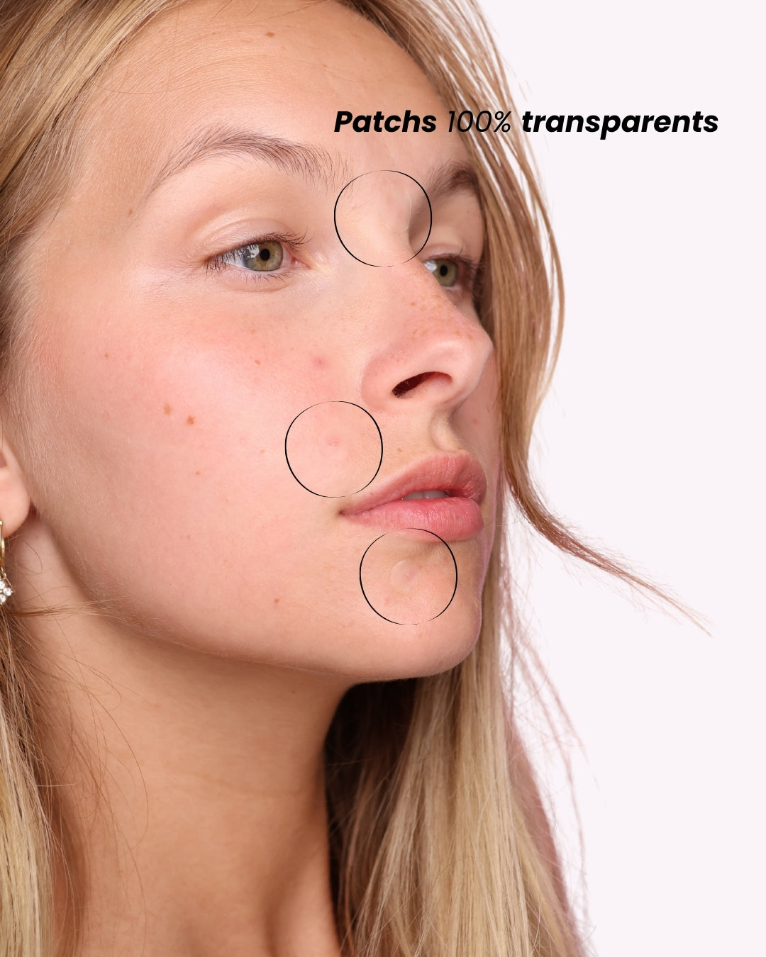 Patch anti-boutons