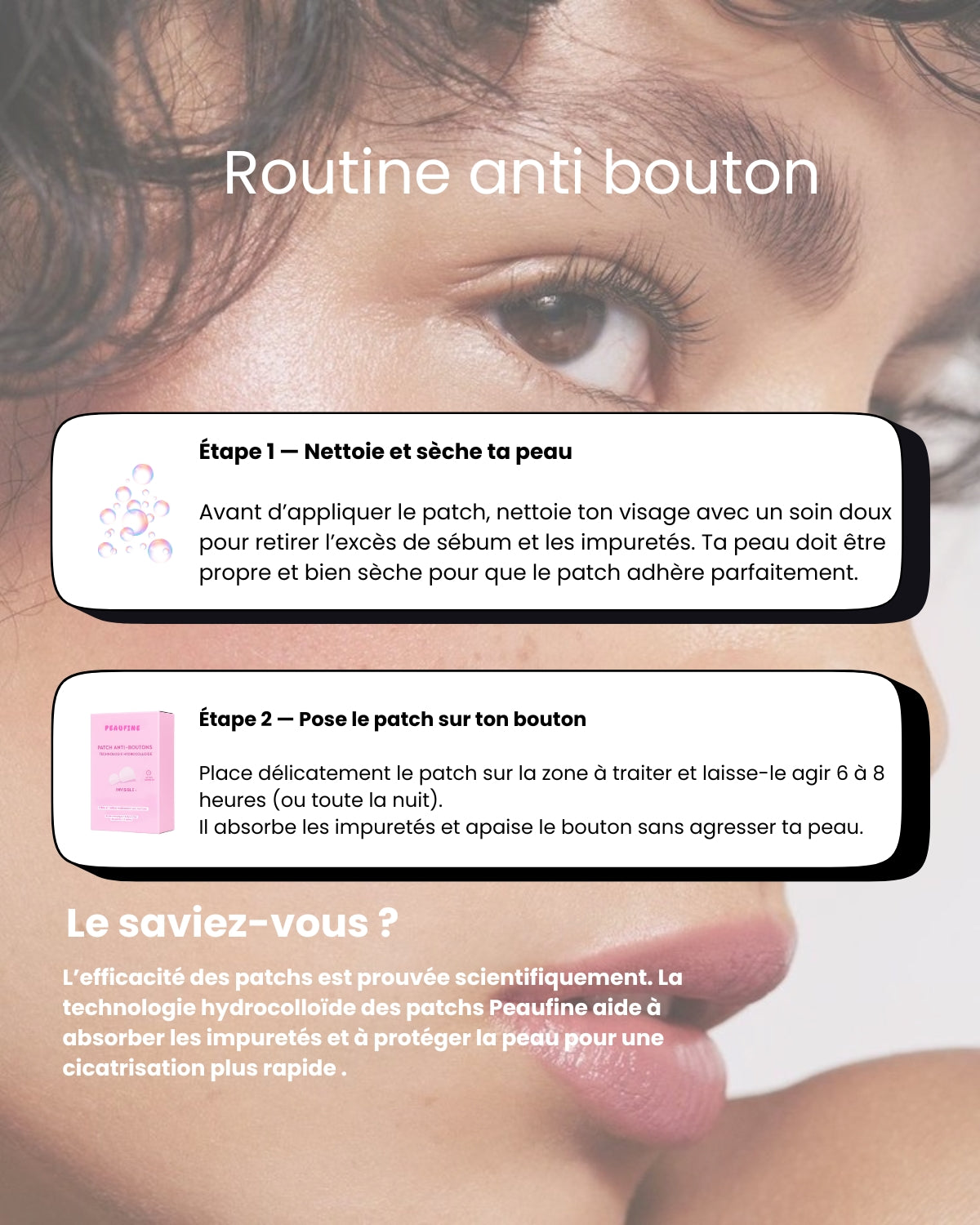 Patch anti-boutons